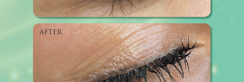 tattoo removal course online